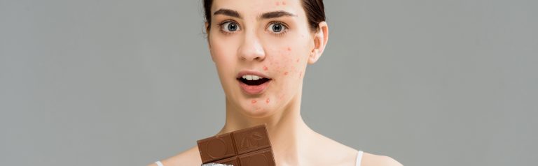Does diet affect acne?