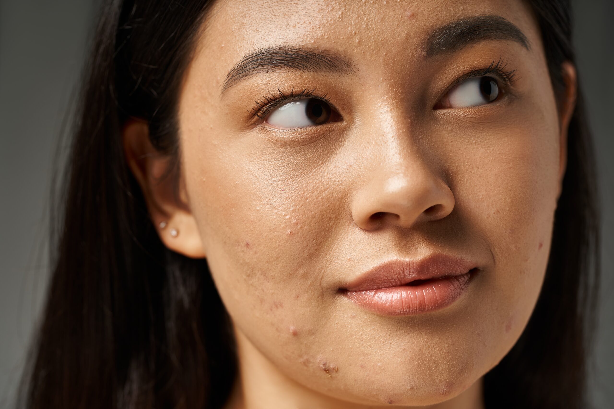 Do You Have a Compromised Skin Barrier? Here's How to Help Science